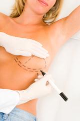 plastic surgery breast augmentation boob job apesos