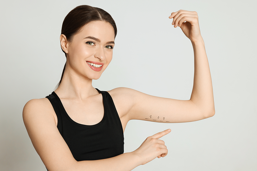 Slim young woman with marks on arm against light background. Arm lift procedure
