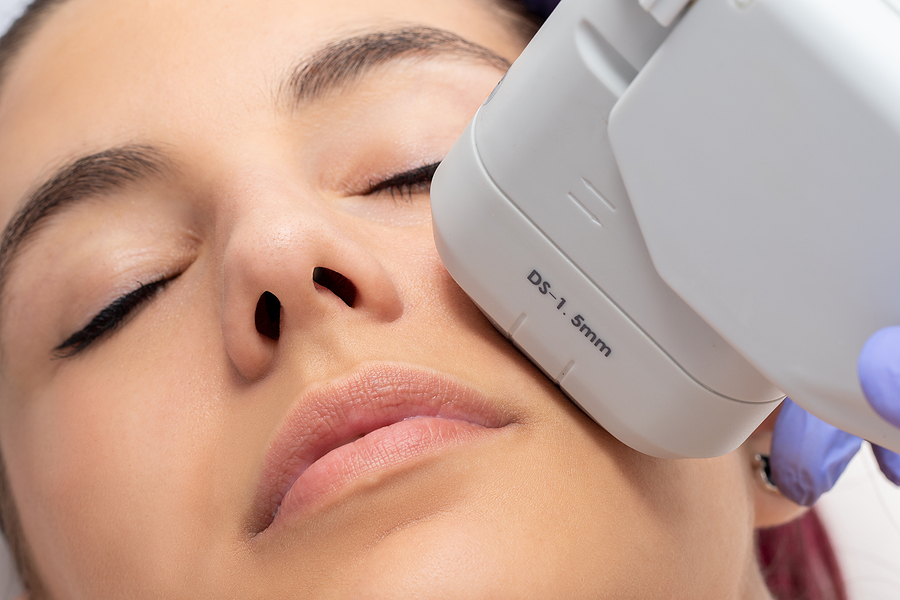 Woman receiving high intensity focused ultrasound treatment on face. One of several Non-Surgical Facelift Options