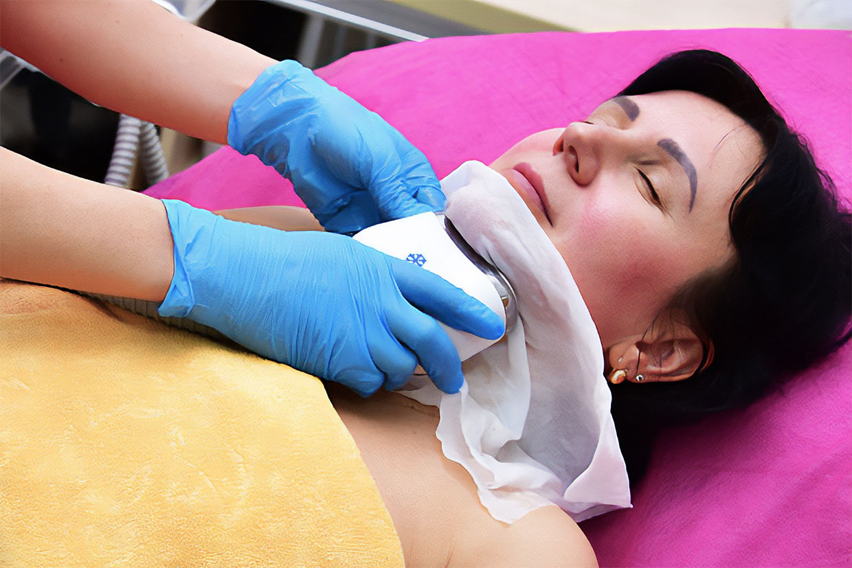 A woman having cryolipolysis to get rid of a double chin