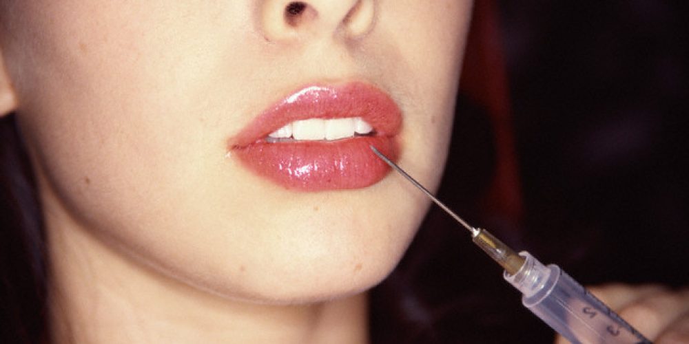 Can Alloderm be used to enlarge the lips?