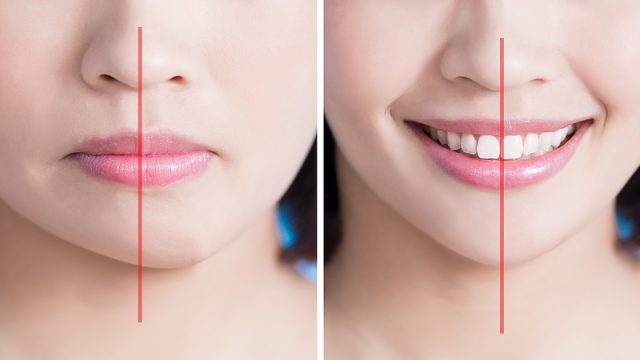 Forehead, Chin, and Cheeks: How Facial Sculpting Procedures Bring Balance to Your Features