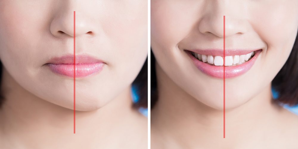 Forehead, Chin, and Cheeks: How Facial Sculpting Procedures Bring Balance to Your Features