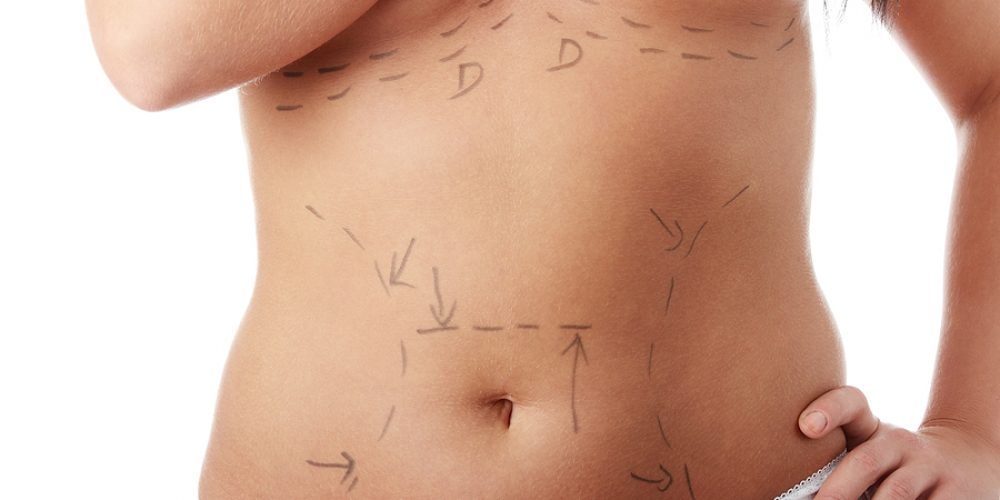 The Benefit of Combining Procedures for Optimal Results in Cosmetic Surgery