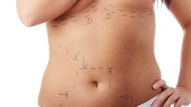 The Benefit of Combining Procedures for Optimal Results in Cosmetic Surgery