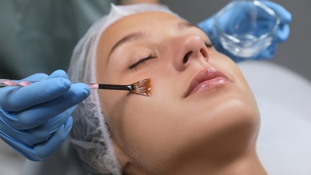 Finding the Right Facial Peel: The 3 Main Types to Consider 
