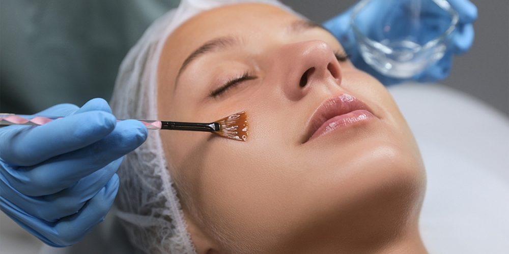 Finding the Right Facial Peel: The 3 Main Types to Consider 