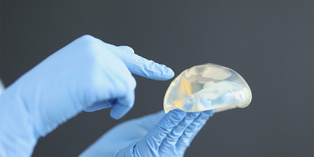 Breast Implant Replacement: What You Need to Know