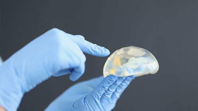 Breast Implant Replacement: What You Need to Know