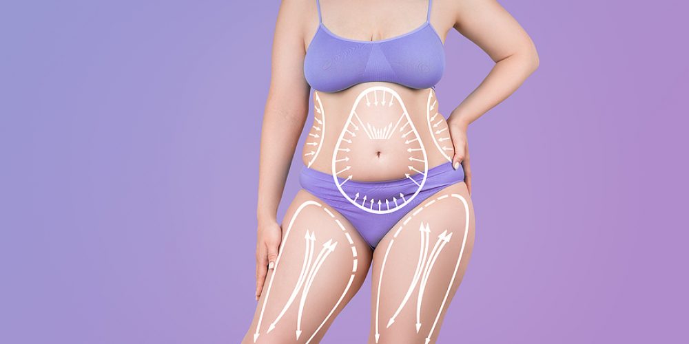 From Head to Toe: The Comprehensive Benefits of Full-Body Cosmetic Surgery for Middle-Aged Women