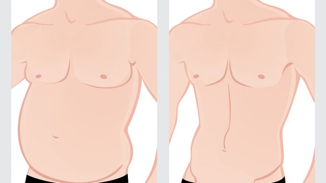 Exploring Male Plastic Surgery: Top Procedures for Men and Growing Trends