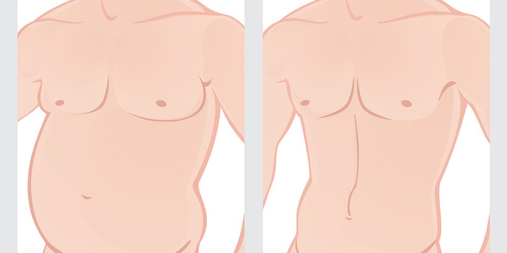 Exploring Male Plastic Surgery: Top Procedures for Men and Growing Trends