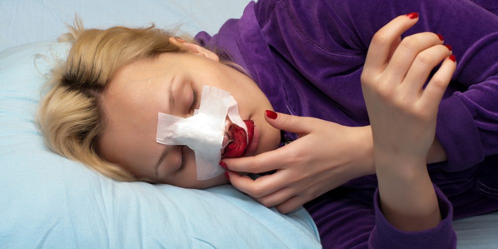 9 Steps You Can Take to Prepare for Your Rhinoplasty Procedure