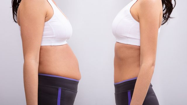 Signs It’s Time to Consider a Tummy Tuck for a Stronger, More Toned Core