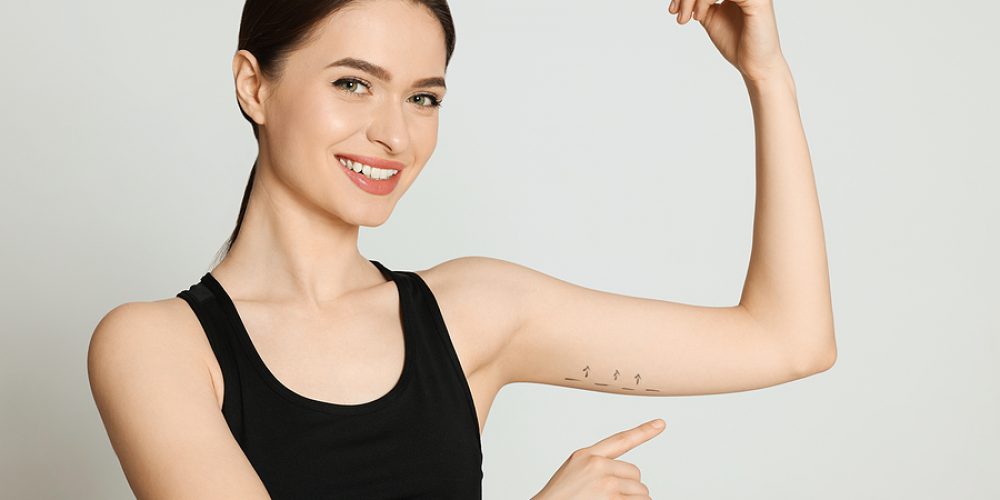 Achieve the Perfect Contour with an Arm Lift and Implants: What You Should Know