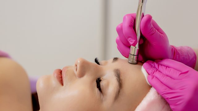 Microdermabrasion Treatments: 9 Things to Know