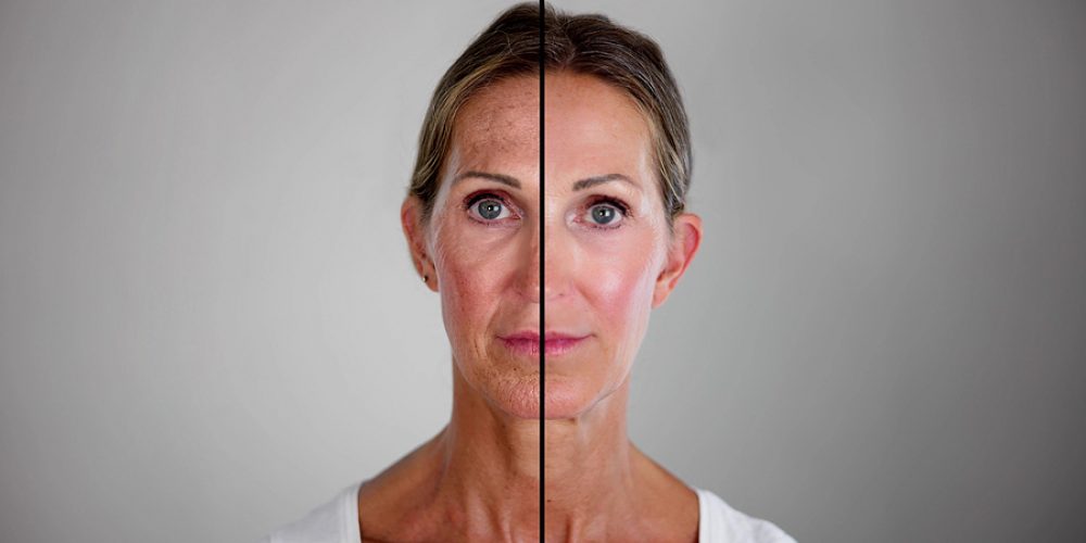 A Fresh Start: How Cosmetic Surgery Can Help Women Embrace Change and Move Forward in Life