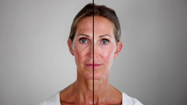 A Fresh Start: How Cosmetic Surgery Can Help Women Embrace Change and Move Forward in Life