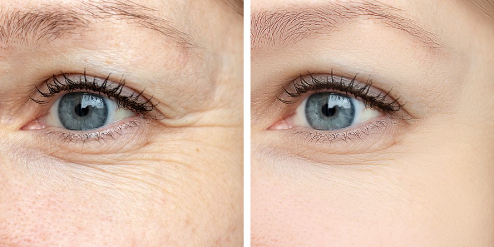 14 Simple Ways to Keep Your Eyes Looking Younger