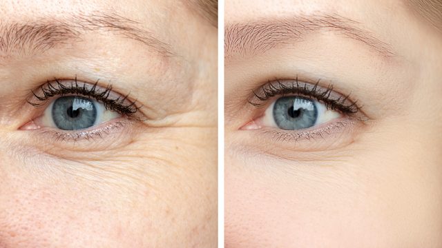 14 Simple Ways to Keep Your Eyes Looking Younger