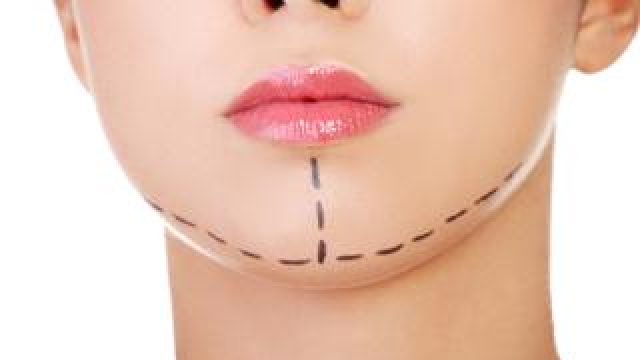 Aesthetic Plastic Surgery
