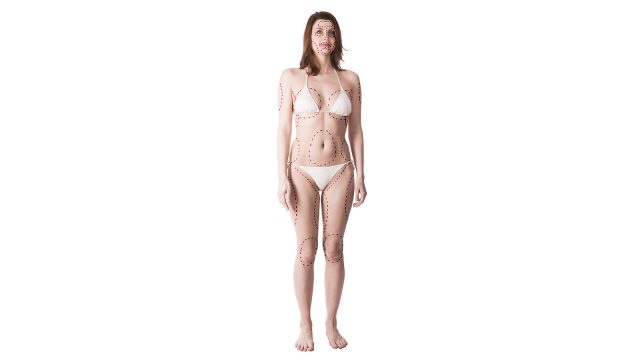 Combining Procedures for Comprehensive Results in General Plastic Surgery