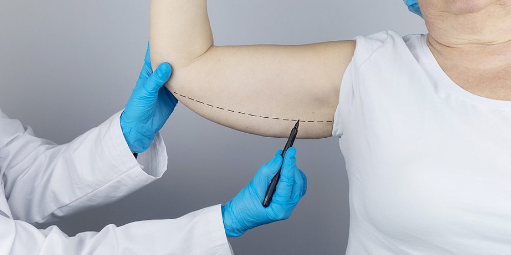 What is it Like to Get an Arm Tuck?