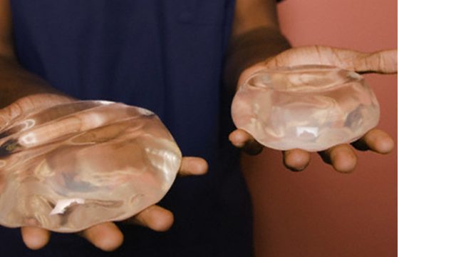 Choosing Between Silicone and Saline Breast Implants