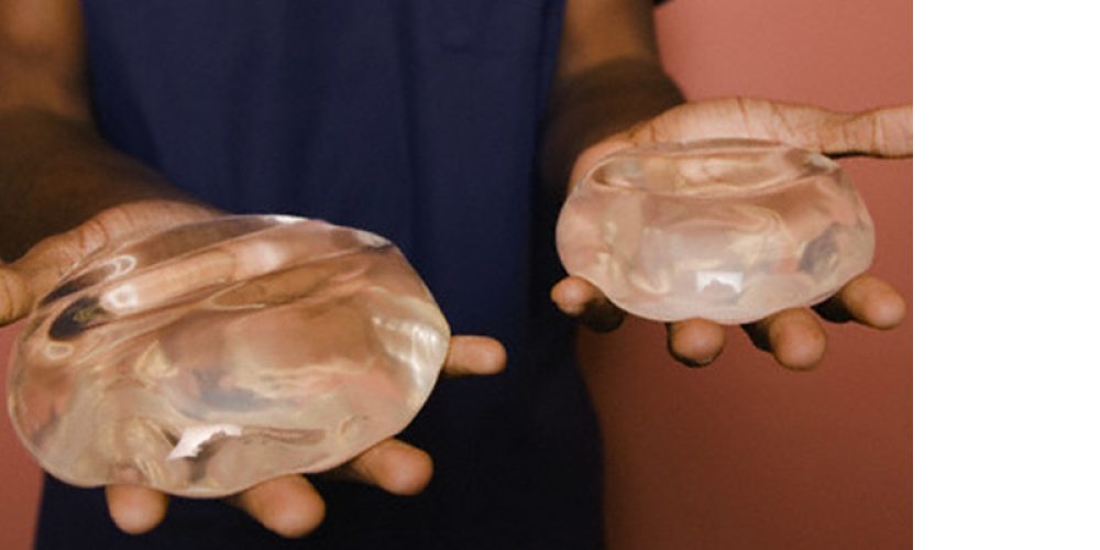 Choosing Between Silicone and Saline Breast Implants