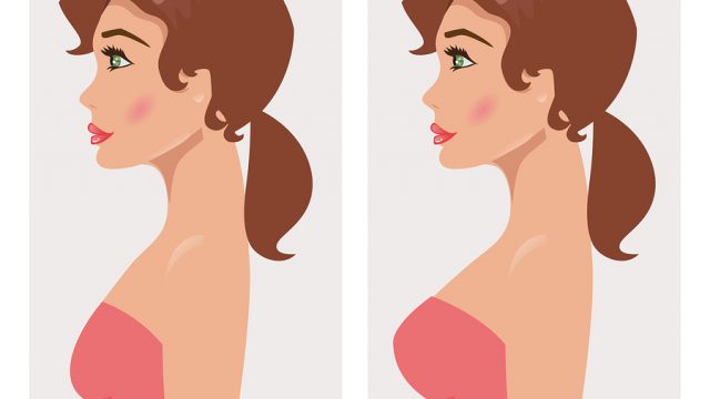 Breast Augmentation For The Realities of Being a Mom